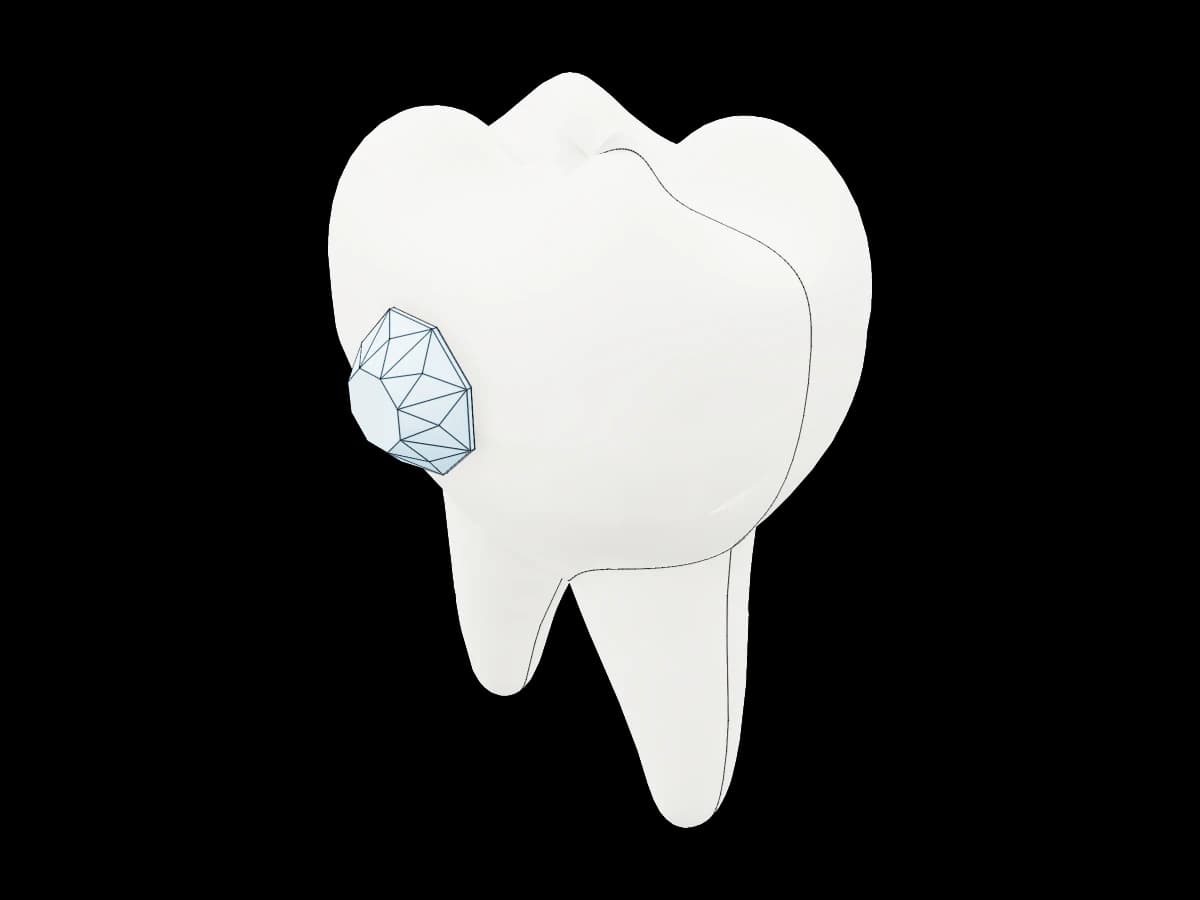 Tooth With Diamond