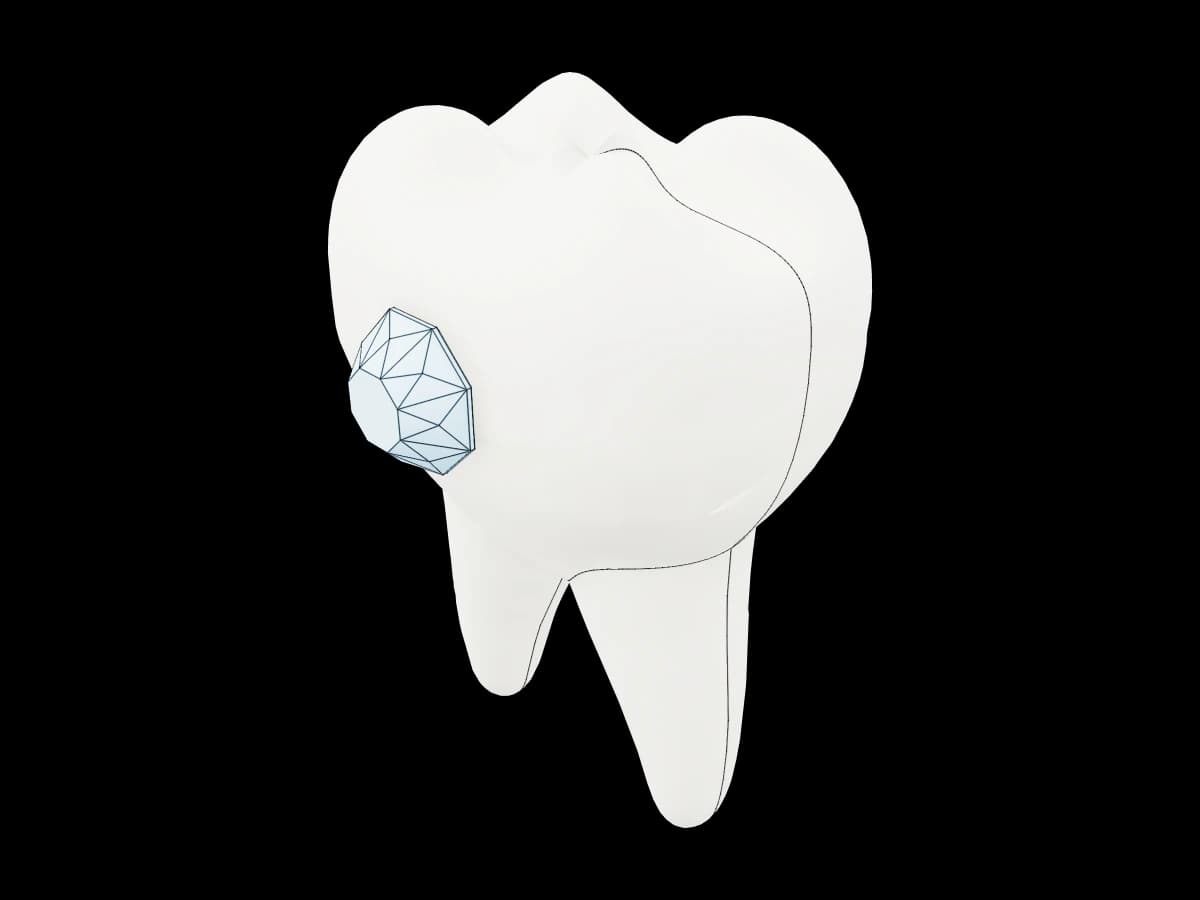 Tooth With Diamond