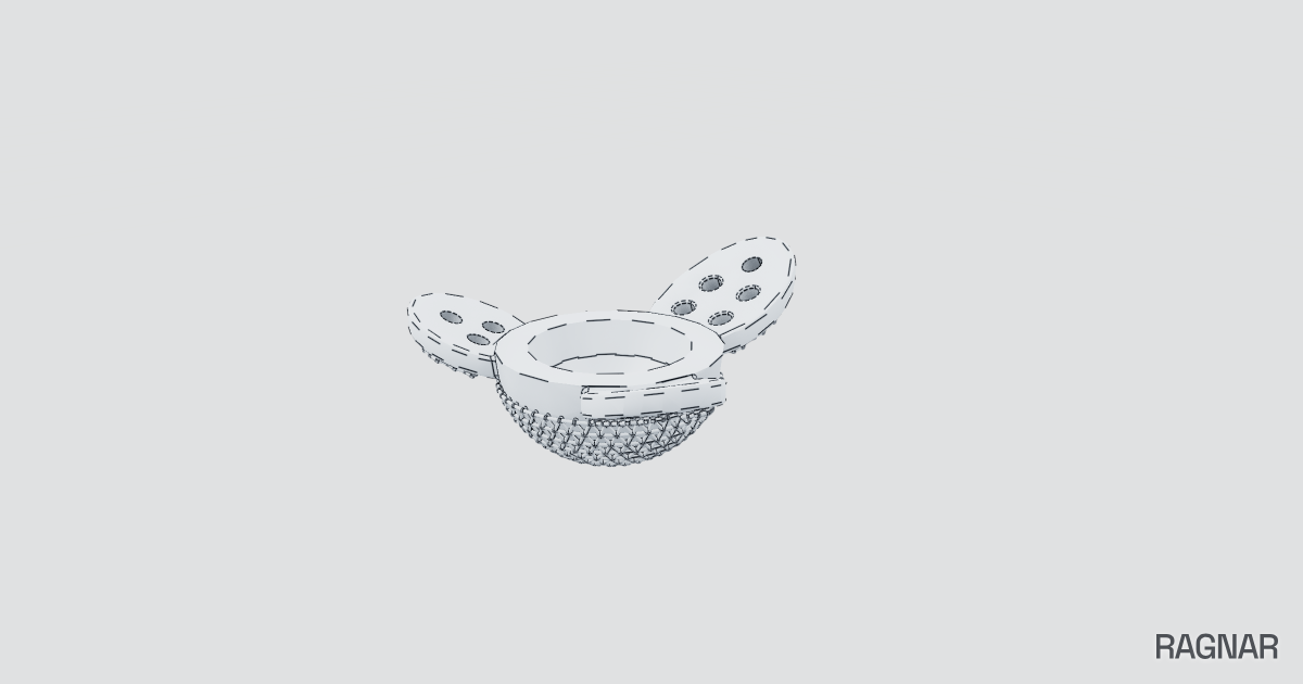 Custom Acetabular Revision Implant | Ragnar Gallery